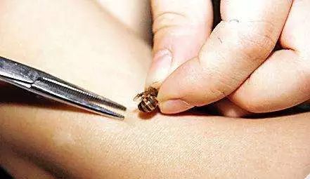 黃蜂的毒液是酸性還是堿性(黃蜂毒液性狀和被蟄后的應急處理) 黃蜂的毒液是酸性還是堿性(黃蜂毒液性狀和被蟄后的應急處理)