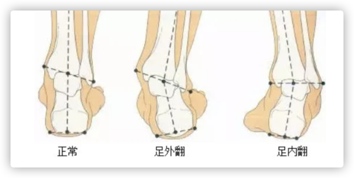真正懂跑步的人,都買了什么樣的跑步鞋 選鞋不求人——這篇文章告訴你跑鞋到底怎么選